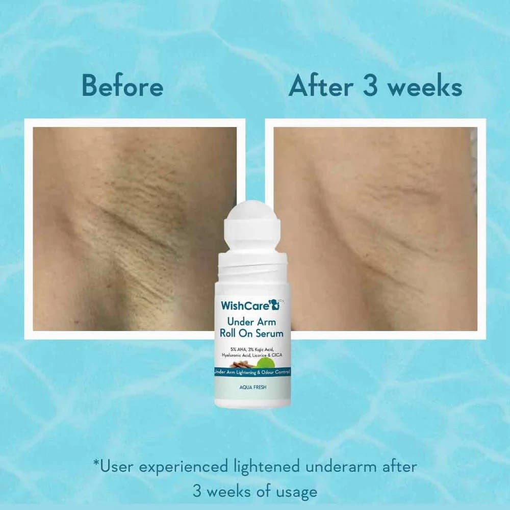 WishCare Under Arm Roll On Serum 50ml — image 4
